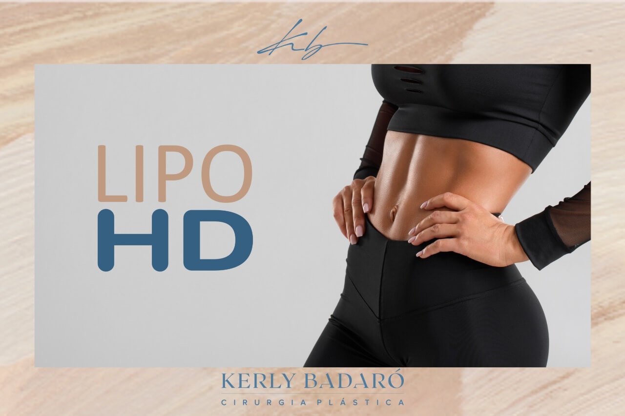 Lipo HD - Marlon Câmara Lopes
